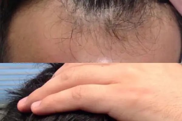 S Clinic Antalya - Saç Çoğaltma, Saç Bakım ve Güzellik Merkezi - Resim 6