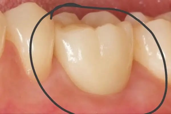 Özel Mimoza Ağız ve Diş Sağlığı Polikliniği ve İmplant Diş Merkezi - Resim 7