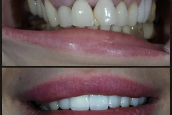 Özel Mimoza Ağız ve Diş Sağlığı Polikliniği ve İmplant Diş Merkezi - Resim 8