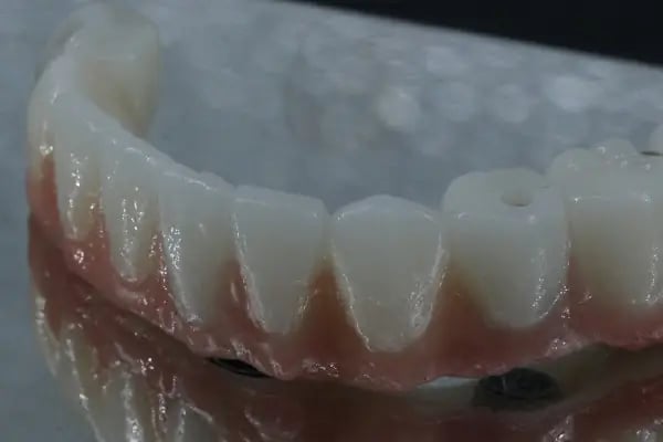 Özel Mimoza Ağız ve Diş Sağlığı Polikliniği ve İmplant Diş Merkezi - Resim 1