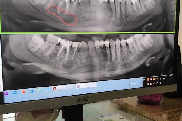 Dt DentalTerapi Firdevs Özçelik Ağız ve Diş Sağlığı Polikliniği - Resim 16