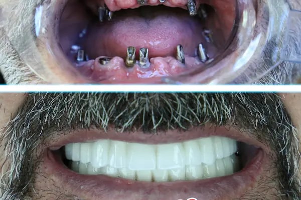 Özel Yiğit Ağız ve Diş Sağlığı Polikliniği - Resim 10