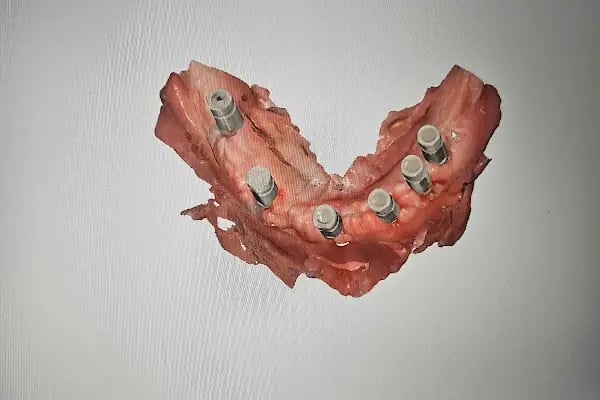 İvrindi Diş Kliniği - Resim 2