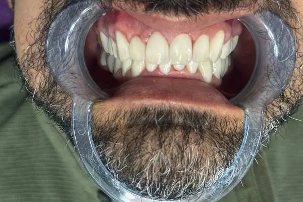 İvrindi Diş Kliniği - Resim 1