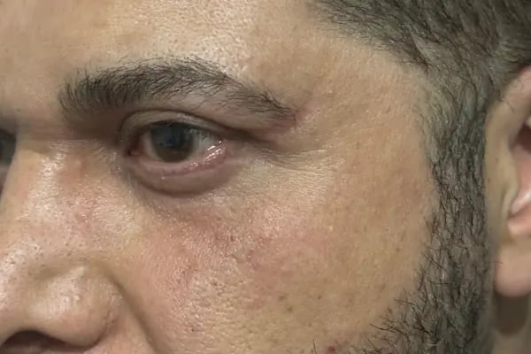 Op. Dr. Gözde Erten - Estetik Plastik Cerrahi Uzmanı - Resim 3