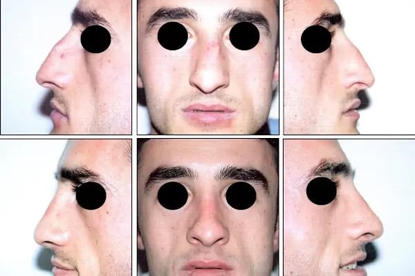 Estetik ve Plastik Cerrah | Doç. Dr. Hasan Mete Aksoy | Kocaeli - Resim 16