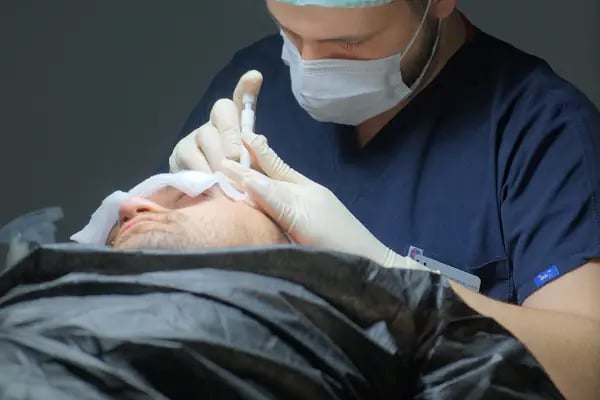 Implant World Hair -BEST HAIR TRANSPLANT CLINIC TURKEY - Resim 15
