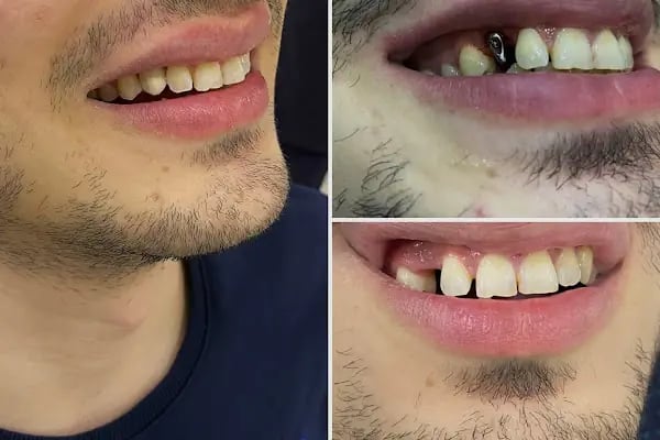 AFİLDENT BAĞCILAR | Ağız ve Diş Sağlığı Polikliniği | BAĞCILAR DİŞ - Resim 12