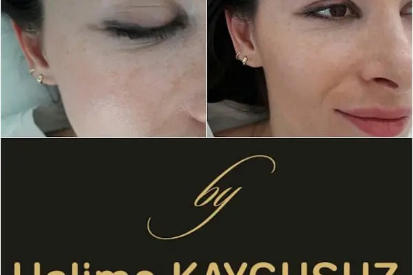 Halime Kaygusuz Medica Beauty - Resim 11