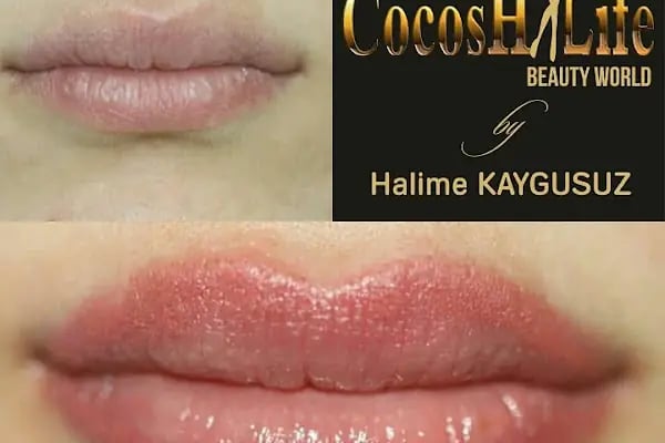 Halime Kaygusuz Medica Beauty - Resim 8