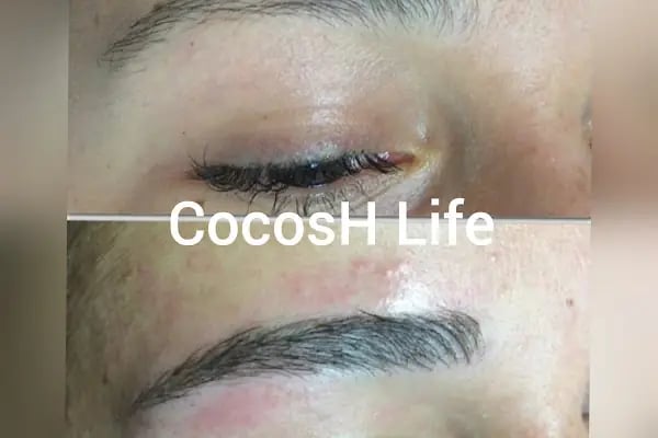Halime Kaygusuz Medica Beauty - Resim 15