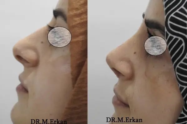 Muhammet Erkan Clınıc - Resim 15