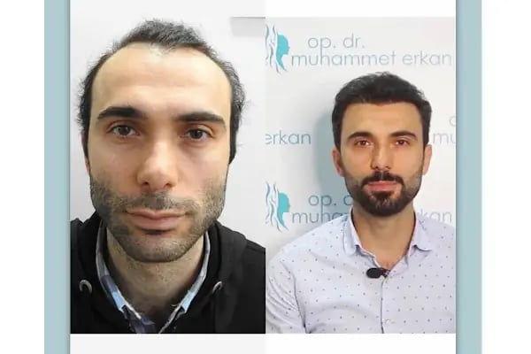 Muhammet Erkan Clınıc - Resim 13