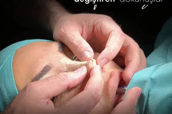 Op. Dr. Çağatay Falcıoğlu I Ankara Rinoplasti I Estetik Cerrahi I Meme Büyütme - Dikleştirme - Küçültme I Liposuction - Resim 8