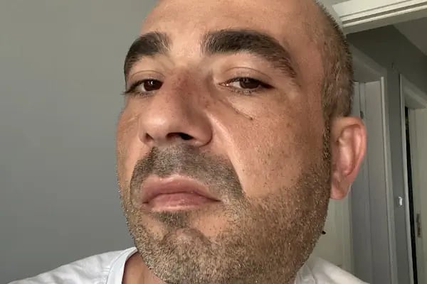 Çayırova Dekadent Diş Kliniği - Resim 8