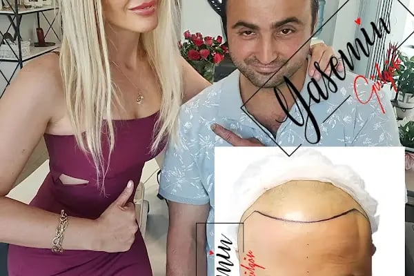 Yasemin Gülgör Sağlık Güzellk Estetik - Resim 18