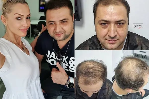 Yasemin Gülgör Sağlık Güzellk Estetik - Resim 13