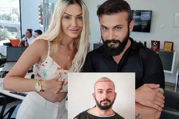Yasemin Gülgör Sağlık Güzellk Estetik - Resim 6