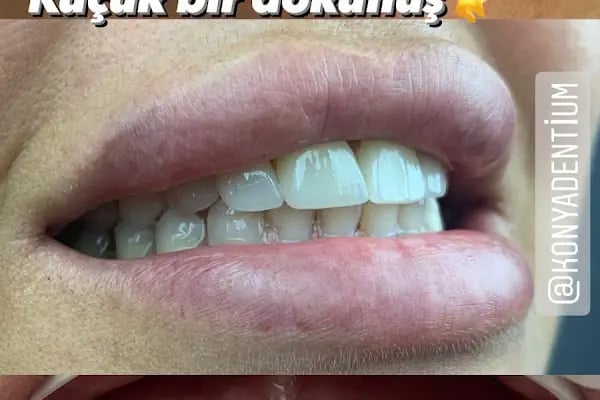 Dt. Ahmet Can Üzümcüoğlu, Diş Hekimi - Resim 5
