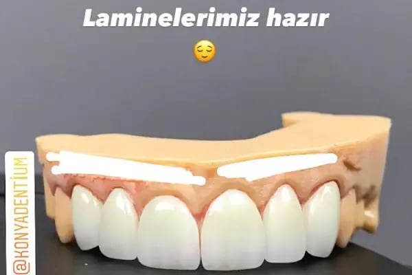 Dt. Ahmet Can Üzümcüoğlu, Diş Hekimi - Resim 16
