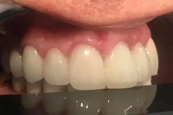 KLİNİK 23 NİSAN AĞIZ VE DİŞ SAĞLIĞI POLİKLİNİĞİ - Resim 12