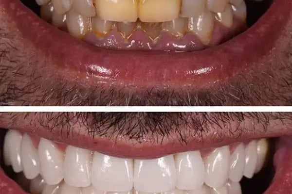 KLİNİK 23 NİSAN AĞIZ VE DİŞ SAĞLIĞI POLİKLİNİĞİ - Resim 2
