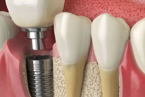 Diş hekimi Diş kliniği - Resim 10