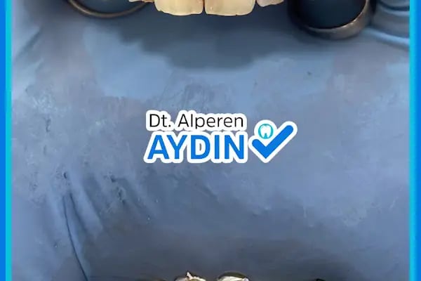 Diş Hekimi Alperen Aydın - Resim 12