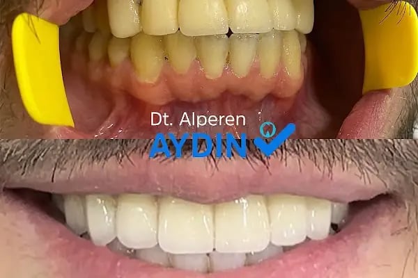 Diş Hekimi Alperen Aydın - Resim 8