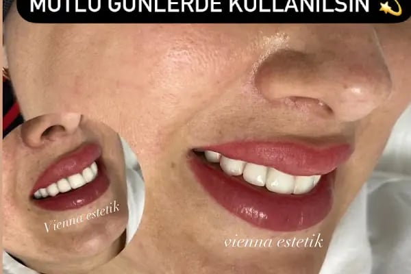 VİENNA GÜZELLİK SALONU - Resim 14