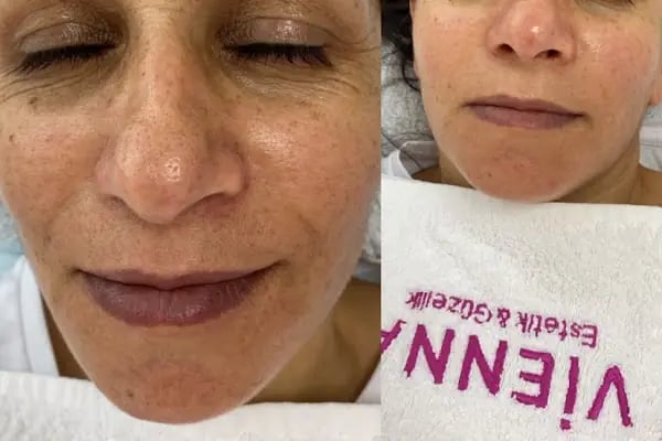 VİENNA GÜZELLİK SALONU - Resim 15