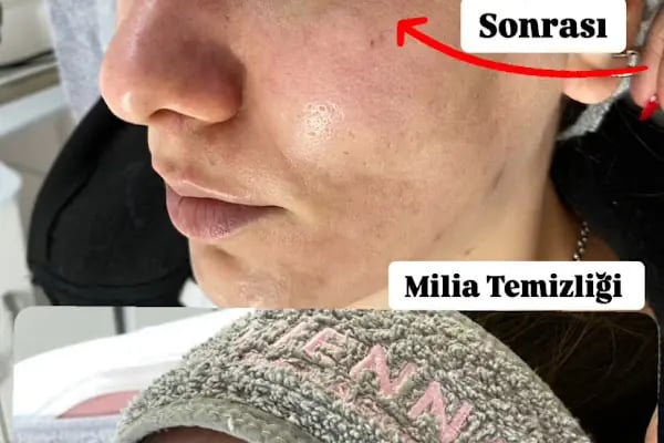 VİENNA GÜZELLİK SALONU - Resim 19
