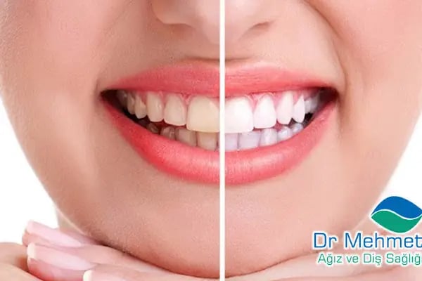 Dr. Mehmet Aydın Ağız Ve Diş Sağlığı Polikliniği - Resim 10