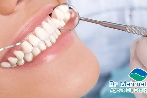 Dr. Mehmet Aydın Ağız Ve Diş Sağlığı Polikliniği - Resim 15