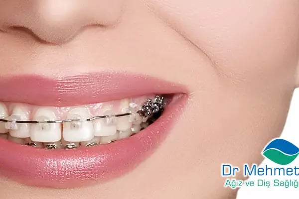 Dr. Mehmet Aydın Ağız Ve Diş Sağlığı Polikliniği - Resim 7