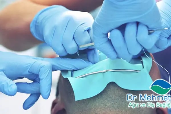 Dr. Mehmet Aydın Ağız Ve Diş Sağlığı Polikliniği - Resim 12