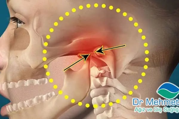 Dr. Mehmet Aydın Ağız Ve Diş Sağlığı Polikliniği - Resim 14