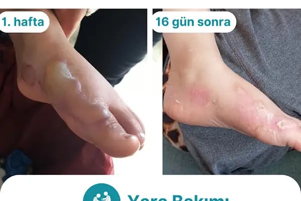 Özel Nurpam Life Sağlık Kabini - Resim 15