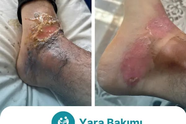 Özel Nurpam Life Sağlık Kabini - Resim 9