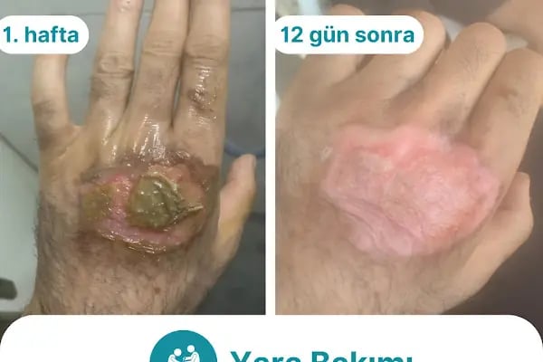 Özel Nurpam Life Sağlık Kabini - Resim 13