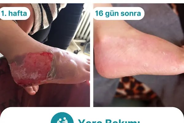 Özel Nurpam Life Sağlık Kabini - Resim 14