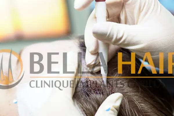 BELLA HAIR - Greffe de Cheveux- DHI-FUE - Resim 2