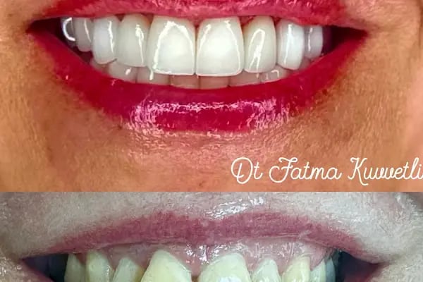 Dt. Fatma Kuvvetli - Resim 13