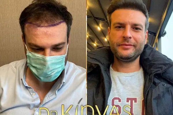 drkinyashairclinic - Resim 10