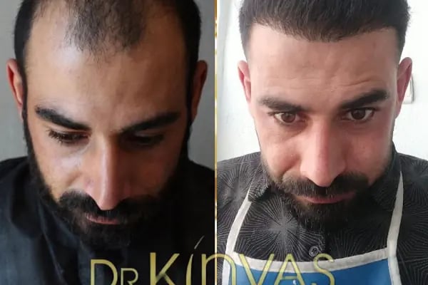 drkinyashairclinic - Resim 16