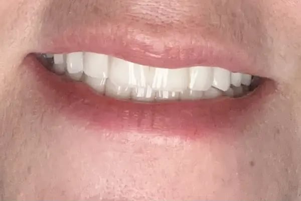 Özel İzmir Dental Klinik Ağız ve Diş Sağlığı Polikliniği - Resim 11