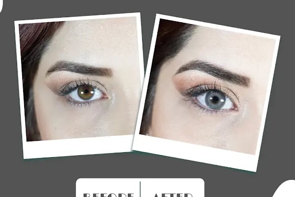 Hadim optik & lens - Resim 10