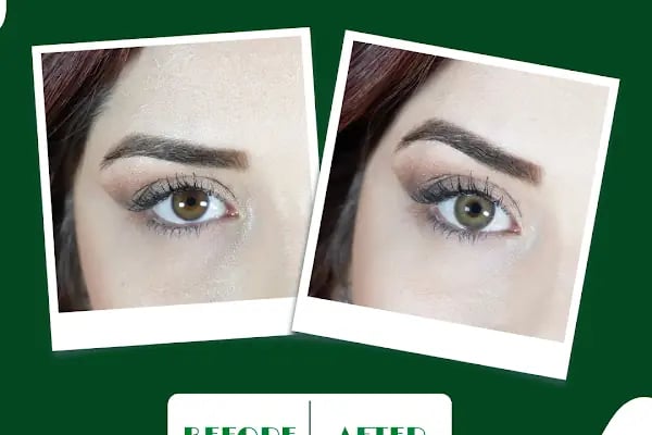 Hadim optik & lens - Resim 18