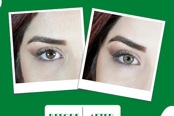 Hadim optik & lens - Resim 11