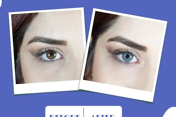 Hadim optik & lens - Resim 12